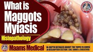 What is Maggots Myiasis Histopathology  Causes Symptoms and Treatment [upl. by Llevram]