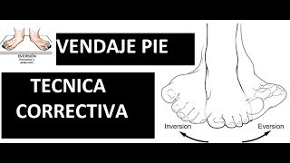 Vendaje neuromuscular corrigiendo la postura del pie en Eversion  Técnica correctiva [upl. by Nirb]