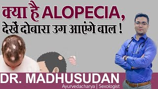 क्या है Alopecia देखें दोबारा उग आएंगे बाल   Hair Regrowth Treatments  Dr Madhusudan [upl. by Tomkiel]