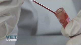 Making a blood smear [upl. by Adolphus]