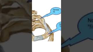 Scalenus anterior muscle  applied anatomy Cervical Rib Anatomy mbbs education [upl. by Ching]