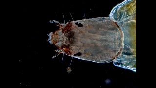 Parasite escaping a mosquito larva [upl. by Beal]