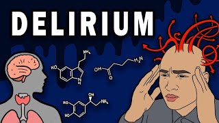 Deliriumand itsPrecipitating Factors😇🥰 [upl. by Marks]