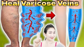 1 Minute Shaking Legs Before Sleep will Remove Swelling and Pain of Varicose Veins [upl. by Etnasa]