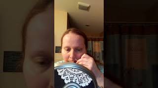 NG Tube Insertion Gastroparesis and Dysautonomia [upl. by Letta376]