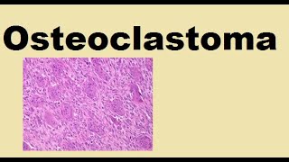 Osteoclastoma  Giant cell tumor [upl. by Ramirol]