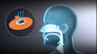 Provent Therapy  An Introduction to the Proven CPAP Alternative [upl. by Eelynnhoj981]