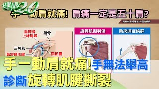 手一動肩就痛！右手無法舉高 診斷旋轉肌腱撕裂 健康20 [upl. by Fishman486]