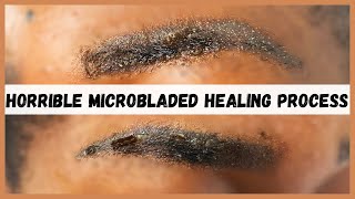 Watch this before you consider microblading your eyebrows  Microblading eyebrows healing process [upl. by Akit]