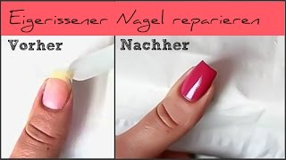 SOS  Eingerissener Nagel reparieren [upl. by Ennayrb213]