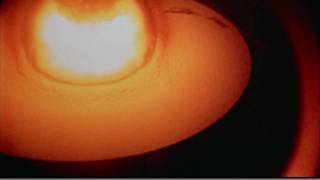 Castle Bravo  Huge thermonuclear explosion [upl. by Eissak]