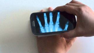 Xray Scan Android Review [upl. by Laven582]