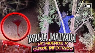 BRUJA MALVADA ME MUERDE Y QUEDO INFECTADO [upl. by Wescott]