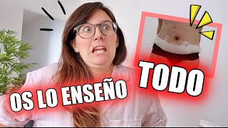 MI CUERPO una semana DESPUÉS DE LA OPERACIÓN ∞ Vlog Happy Ohana [upl. by Benildas]