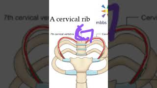 Anatomy Thorax 212 cervical rib viva [upl. by Trawets826]