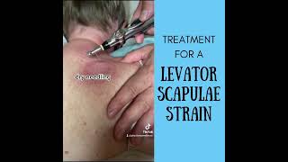 Treatment for Levator Scapulae Strain [upl. by Maunsell]