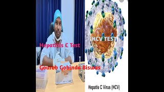 HCV test in BanglaHepatitis test in BanglaHepatitis C Hepatitis C TestHCV testLiver test [upl. by Rema]