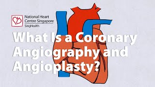 The lifesaving procedure you need to know about  Coronary Angiography [upl. by Greyson]