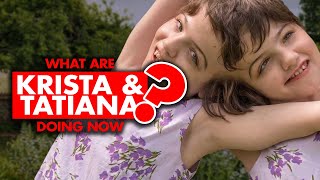 What are conjoined twins Krista and Tatiana Hogan doing now [upl. by Eelana]