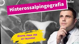 Histerossalpingografia  exame para ver as trompas [upl. by Akcirederf]