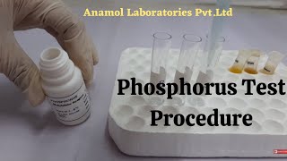 Phosphorus Test  Phosphorus Blood Test [upl. by Bible]