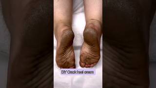 DIY Cracked Heels CreamGet Rid Of Cracked Heels Winter Special Cracked Feet Cream ytshortsviral [upl. by Eycal]