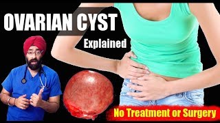 Ovarian Cyst  Follicular Cyst  No Treatment or Surgery  Explained in ENG by DrEducation [upl. by Annaehs554]