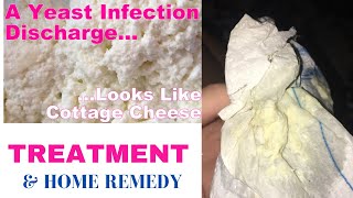 Vaginal Yeast Infection and Treatment [upl. by Ashbaugh]