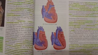 Right to Left Shunts  SPECIAL PATHOLOGY [upl. by Ruffi339]
