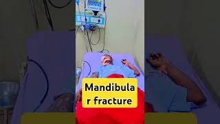 Mandibular fracture  mandular fracture surgery  mandibular surgery care [upl. by Resarf9]