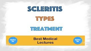 Scleritis symptoms and treatment lecture [upl. by Finkelstein]