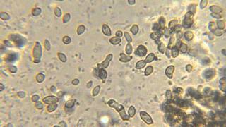 Bacteria and yeast movement microscope video [upl. by Anyrak388]