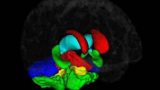 Brain Morphometry  Brain Image Analysis [upl. by Menedez]