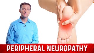 How to Relieve Peripheral Neuropathy Pain – Dr Berg [upl. by Justine]