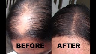 4 MAKEUP HOW TO GET A SCALP LINE OR NATURAL PART FOR THIN HAIR [upl. by Choong]