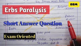 Erbs paralysis  Anatomy  Brachial Plexus [upl. by Beckman]