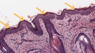 Stratified Squamous Non Keratinized and Keratinized Epithelium [upl. by Nifled636]