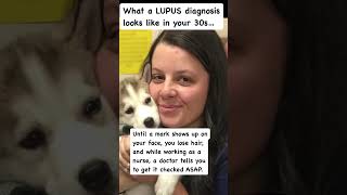 What a LUPUS diagnosis in your 30s looks like lupus lupusawareness momlife reallife lessons [upl. by Oster]