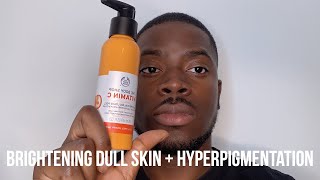 HOW I GOT RID OF DARK SPOTS BRIGHTEN DULL SKIN  HYPERPIGMENTATION [upl. by Azmah851]