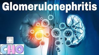 Glomerulonephritis  Kidney  Notes [upl. by Aimo]