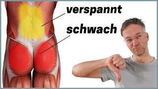 Die häufigste Ursache für Rückenschmerzen Anatomie erklärt [upl. by Sivlek]