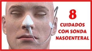 Cuidados de Enfermagem com Sonda Nasoenteral [upl. by Llimaj]