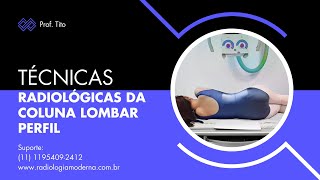 Técnicas Radiológicas da coluna lombar Perfil [upl. by Avuha793]