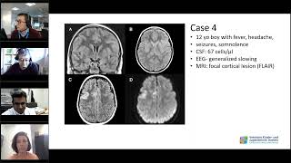 How do I treat Childhood Autoimmune Encephalitis  Tuesday Lunch with RITA [upl. by Pappas]