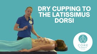 What is cupping and how to do it yourself  Silicone cupping set [upl. by Aicnarf625]