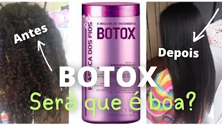 Botox plástica dos fiosoq eu achei passo a passo [upl. by Atinnor]