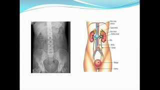 Aula 7 Urografia excretora [upl. by Zaller]