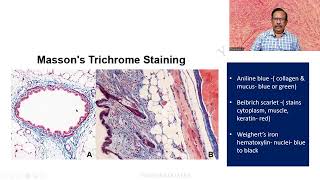 MD DNB Practical CONNECTIVE TISSUE STAINS Massons Trichrome Univ Exam [upl. by Iak]