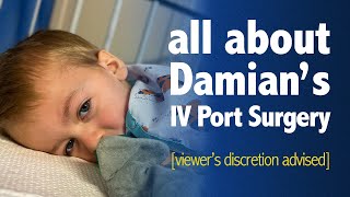 ALL about Damians IV PORT SURGERY 26 Feb 2022 [upl. by Evante]