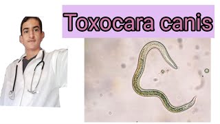 Toxocara canis toxocarose [upl. by Grane]